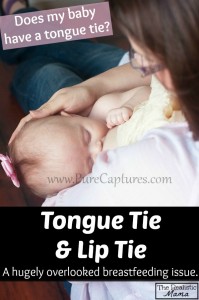 Tongued Tied Baby. Tongue tie is a hugely overlooked breastfeeding issue, the article includes warning signs to look for.