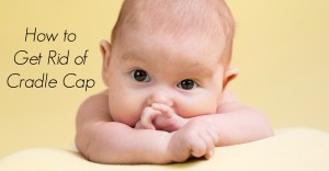 Get Rid of Cradle Cap