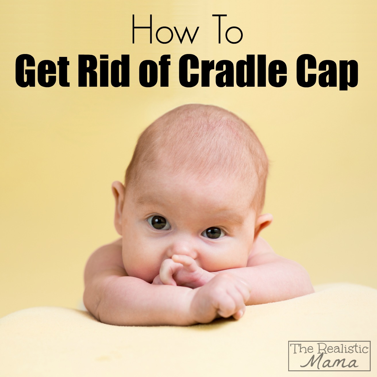 How to Get Rid of Cradle Cap