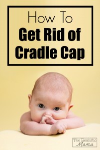 How to get rid of cradle cap, the easy way!