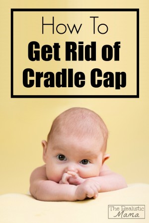 How to get rid of cradle cap, the easy way!
